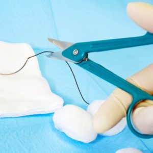 surgical scissors cutting the suture thread
